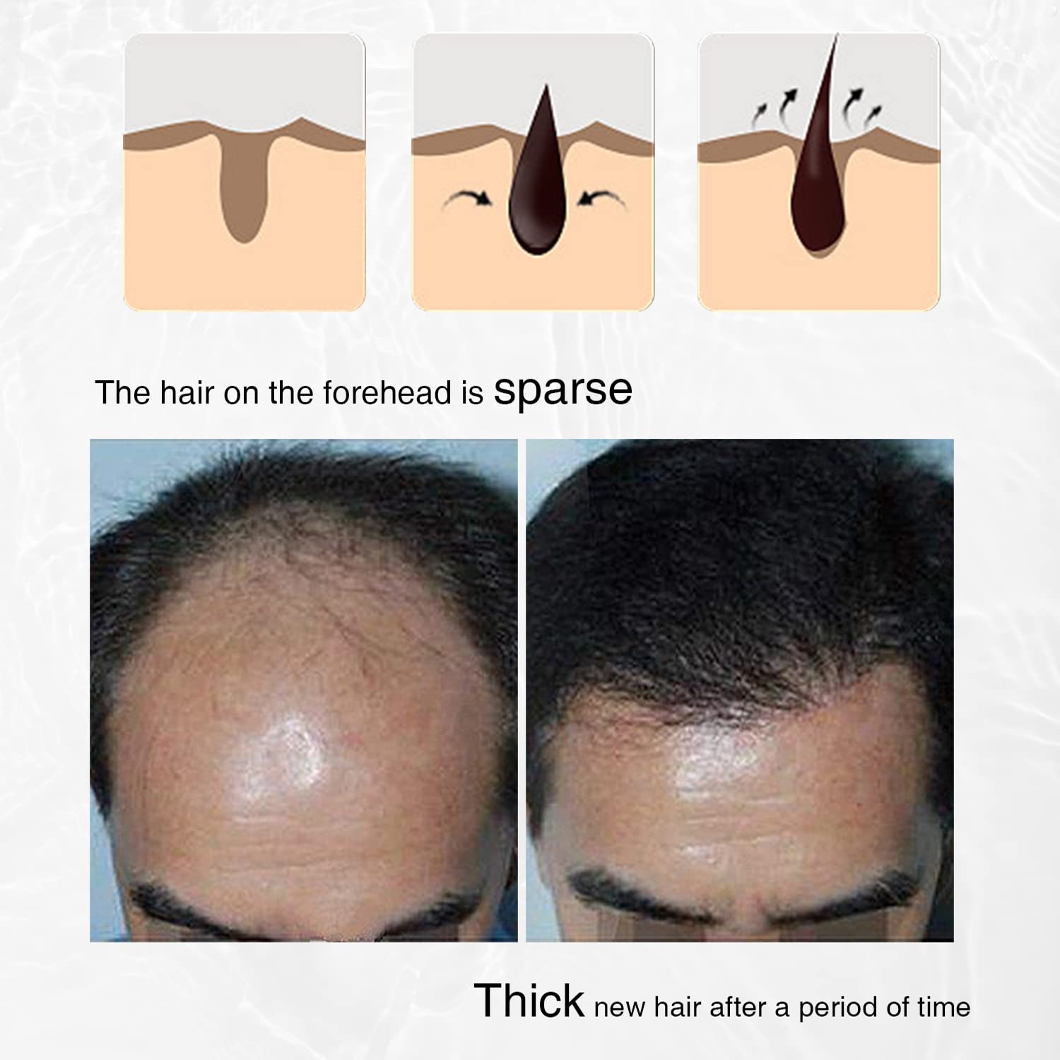 Hair Growth Spray, Organic Onion Oil with Rosemary Scent, Enriched with Black Seed Oil, Controls Hair Loss, Promotes Growth, for Women and Men