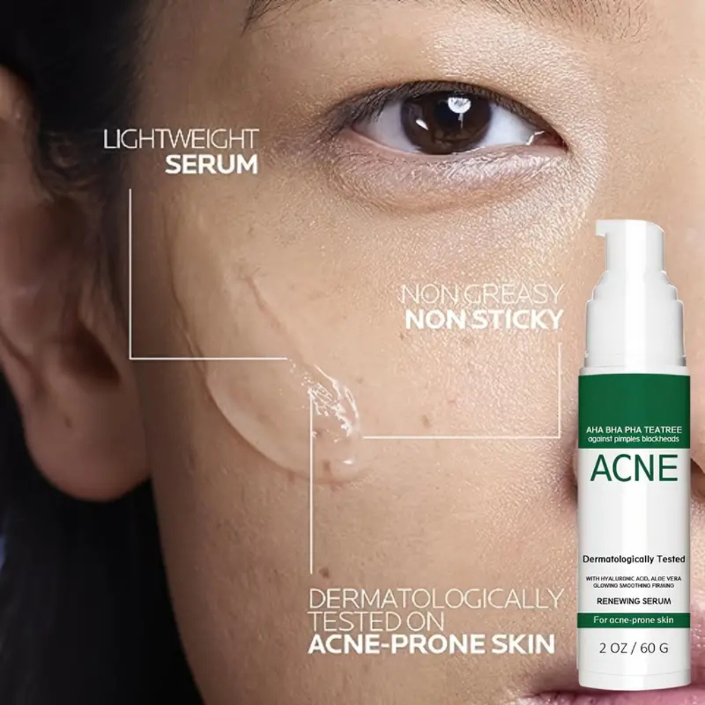 Tea Tree Acne Gel with AHA, BHA, PHA - Oil-Free Exfoliating Serum for Smooth, Soft Skin - Moisturizing Formula with Alpha Hydroxy Acids, Salicylic Acid, and Aloe Vera - alternate view 5