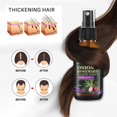 Hair Growth Spray, Organic Onion Oil with Rosemary Scent, Enriched with Black Seed Oil, Controls Hair Loss, Promotes Growth, for Women and Men