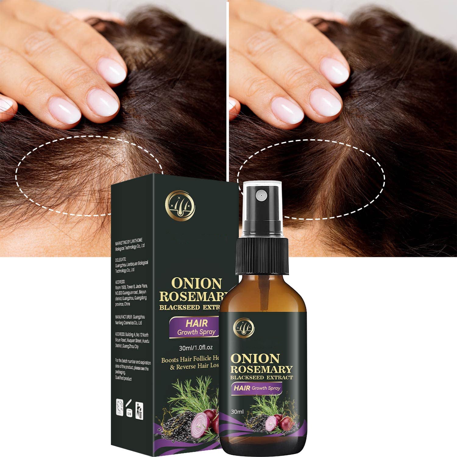 Hair Growth Spray, Organic Onion Oil with Rosemary Scent, Enriched with Black Seed Oil, Controls Hair Loss, Promotes Growth, for Women and Men